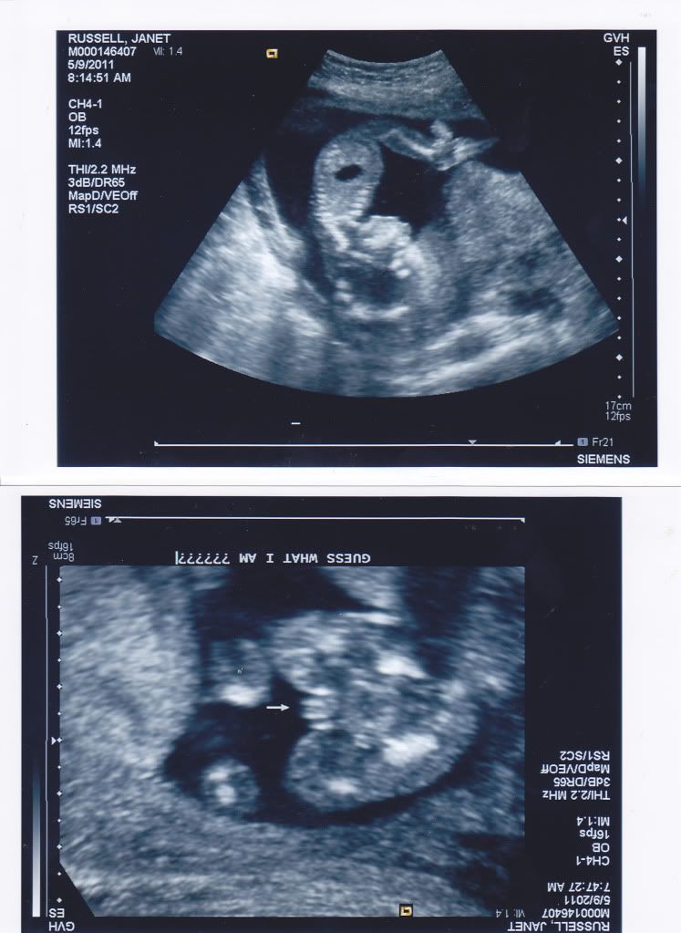 Ultrasounds Of Boys. My oys got such a kick out of